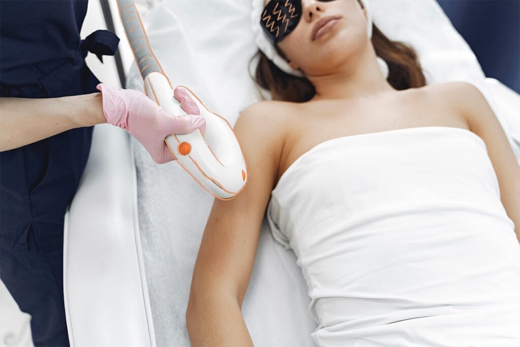 Depilacion laser