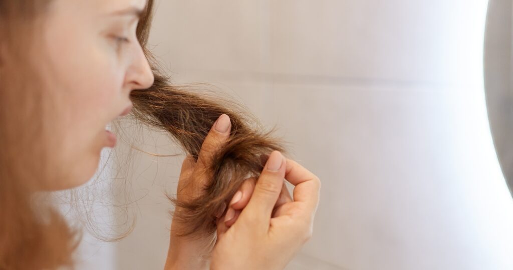 Caída de pelo postparto